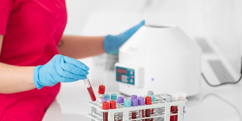 badania krwi, badania krwi Poznań, badania laboratoryjne, punkt pobrań, badania z krwi, Poznań