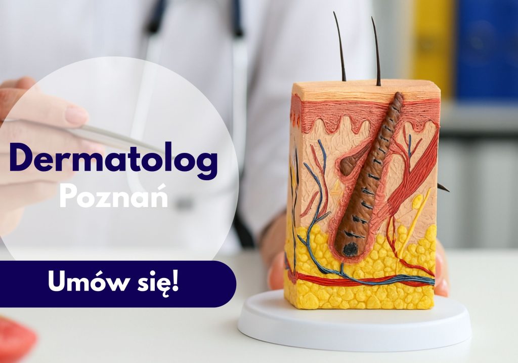 Dermatolog Centrum Medyczmego neoMedica w Poznaniu wskazuje na model przekroju skóry.