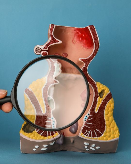 Lupa przykłądana do modelu końcowego odcinka jelita grubego - ilustracja dotycząca anoskopii w Centrum Medycznym neoMedica w Poznaniu.