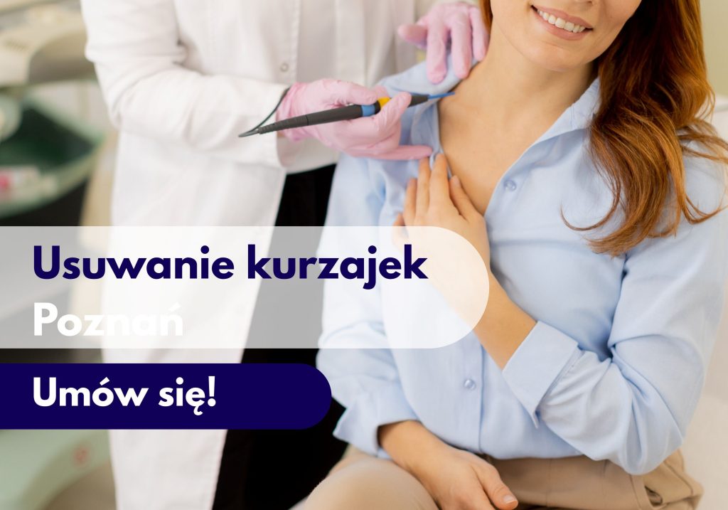 Kobieta odsłaniająca bark i lekarz w rękawiczkach lekarskich przykładający narzędzie do usuwania kurzajek - ilustracja dotycząca usuwania kurzajek w Centrum Medycznym neoMedica w Poznaniu.