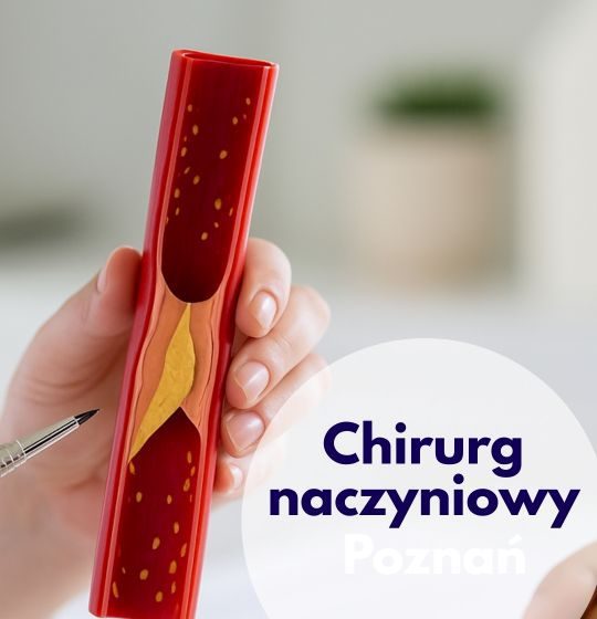 Chirurg naczyniowy Centrum Medycznego neoMedica w Poznaniu wskazuje na model naczycia krwionośnego.