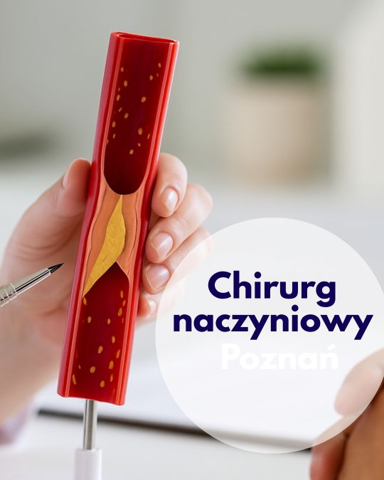 Chirurg naczyniowy Centrum Medycznego neoMedica w Poznaniu wskazuje na model naczycia krwionośnego.