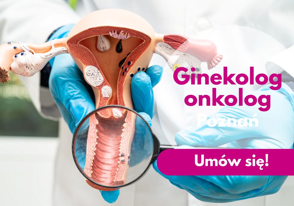 Ginekolog onkolog w rękawiczkach lekarskich przykładający lupę do modelu macicy - ilustracja dotycząca konsultacji ginekologiczno-onkologicznych w Centrum Medycznym neoMedica w Poznaniu.