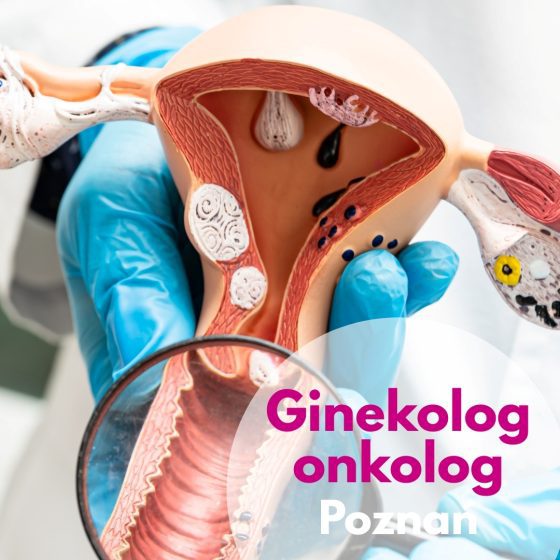 Ginekolog onkolog w rękawiczkach lekarskich przykładający lupę do modelu macicy - ilustracja dotycząca konsultacji ginekologiczno-onkologicznych w Centrum Medycznym neoMedica w Poznaniu.