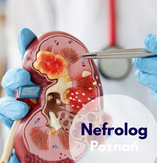 Nefrolog Centrum Medycznego neoMedica w Poznaniu w rękawiczkach lekarskich i stetoskopem na szyi wskazuje na model przekroju nerek.