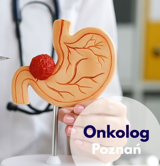 Lekarz onkolog ze stetoskopem na szyi wskazuje na model narządu z guzkiem nowotworowym podczas wizyty onkologicznej w Centrum Medycznym neoMedica w Poznaniu.