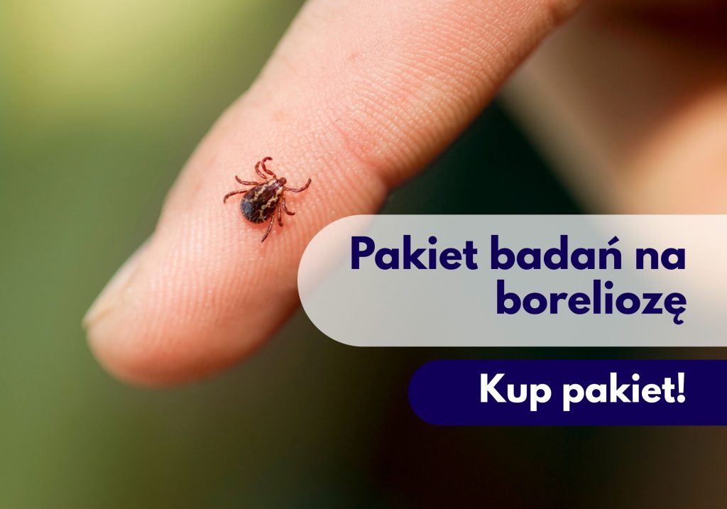 Kleszcz na palcu - ilustracja dotycząca Pakietu badań na boleriozę w Centrum Medycznym neoMedica w Poznaniu