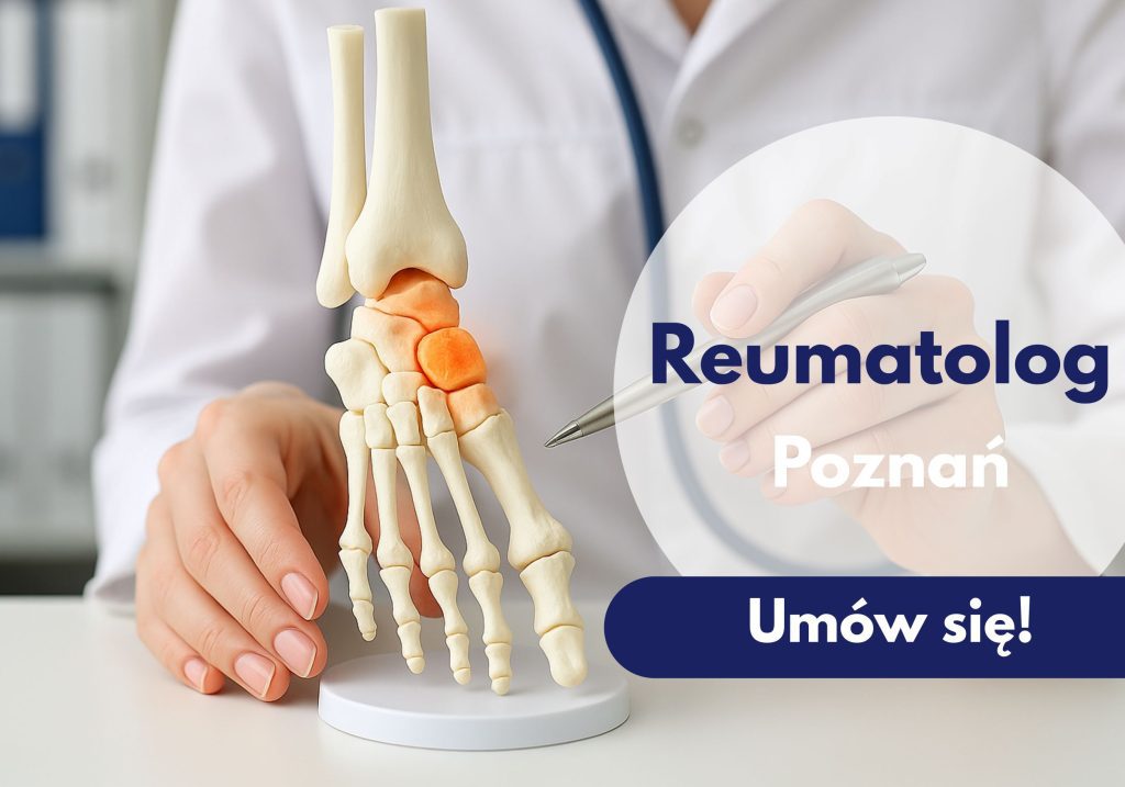 Lekarz reumatolog wskazujący na model kostny stopy podczas wizyty w Centrum Medycznym neoMedica w Poznaniu.