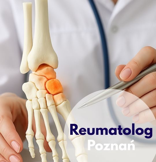 Lekarz reumatolog wskazujący na model kostny stopy podczas wizyty w Centrum Medycznym neoMedica w Poznaniu.