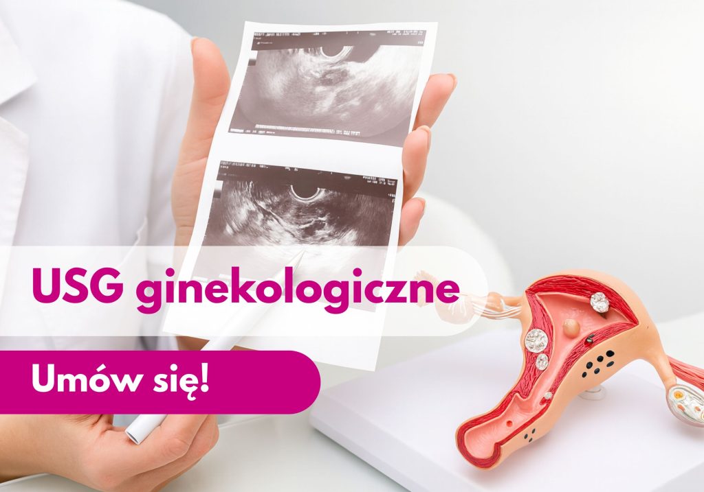 Lekarz ginekolog trzymający zdjęcie z USG, obok figurka narządu macicy - ilustracja dotycząca USG ginekologicznego w Centrum Medycznym neoMedica w Poznaniu.