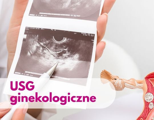 Lekarz ginekolog trzymający zdjęcie z USG, obok figurka narządu macicy - ilustracja dotycząca USG ginekologicznego w Centrum Medycznym neoMedica w Poznaniu.