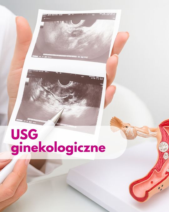 Lekarz ginekolog trzymający zdjęcie z USG, obok figurka narządu macicy - ilustracja dotycząca USG ginekologicznego w Centrum Medycznym neoMedica w Poznaniu.